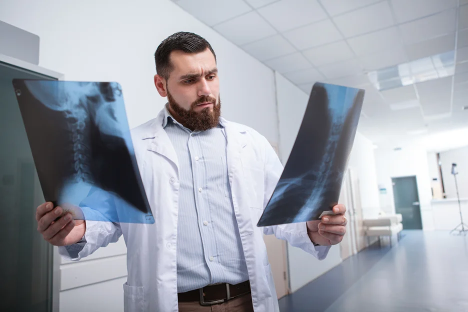 doctor checks the x-ray scans of the neck