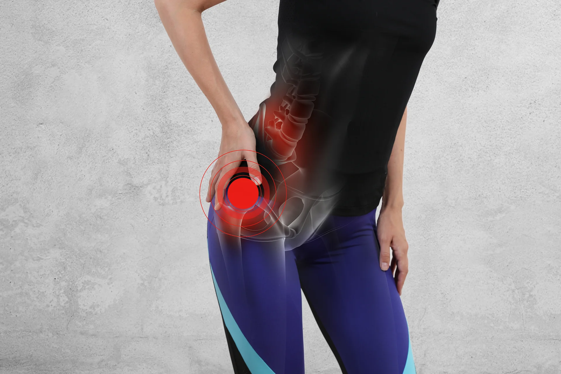 hip misalignment causes sciatica pain