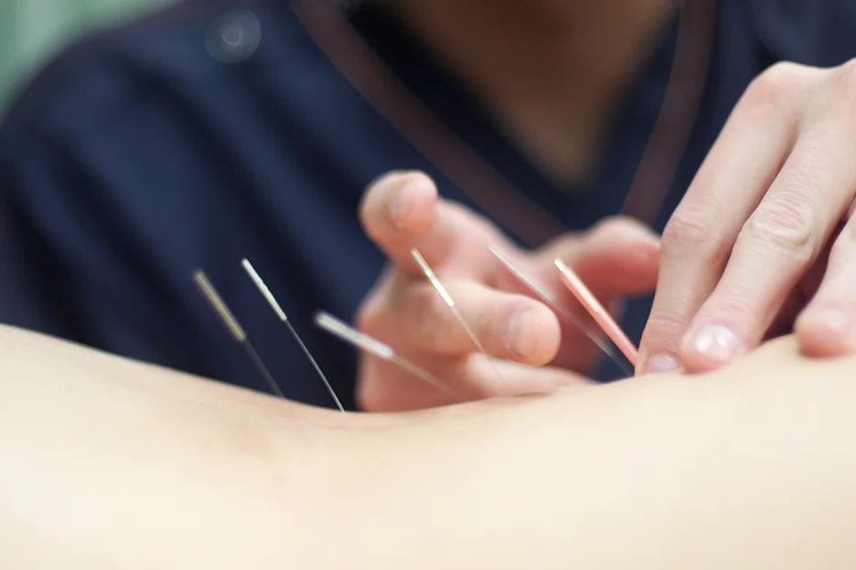 acupuncture for fibroids and sciatica nerve pain