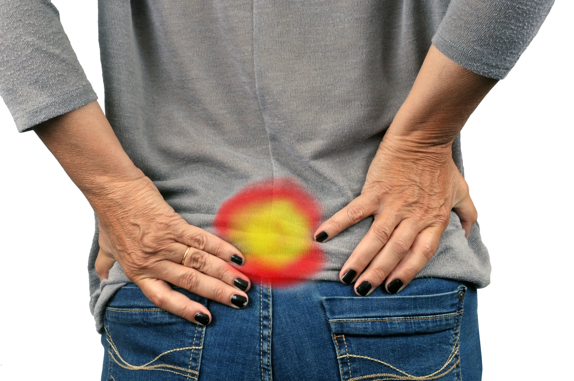 sciatica pain