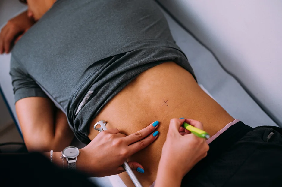 a doctor marks the back of a patient for laser therapy on sciatica pain relief