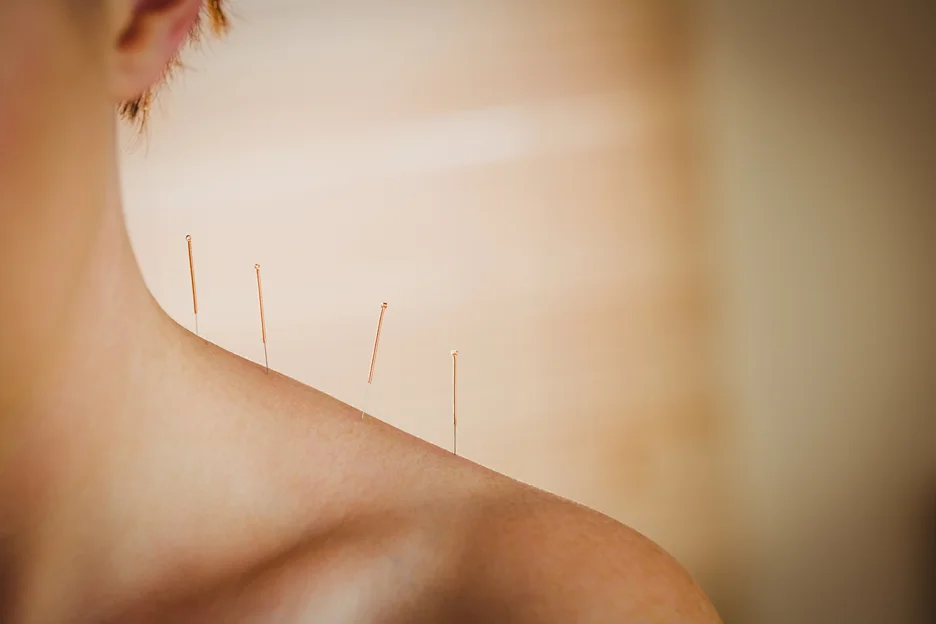 acupuncture for ear and neck pain