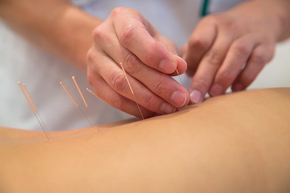 acupuncture for lower back pain when standing